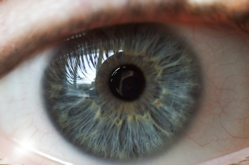 Digital Retina Imaging Sharon, MA 