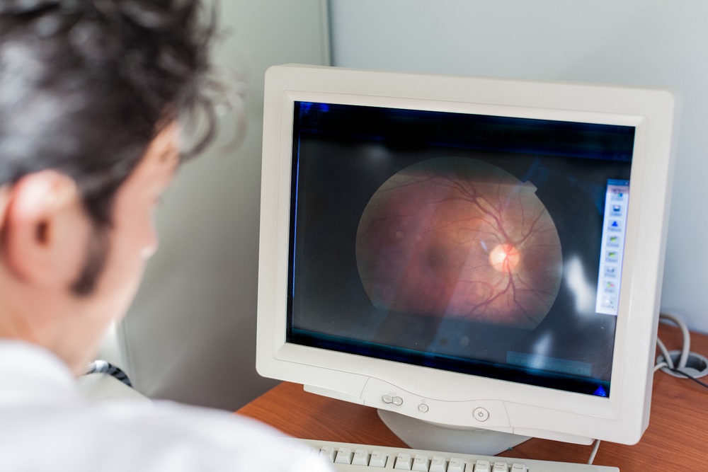 Digital Retina Imaging Sharon, MA 